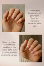 Load image into Gallery viewer, Eternal TT Doğal Tırnak Bakım Serumu – Bitkisel Yağ Karışımı ile Güçlü ve Sağlıklı Tırnaklar
